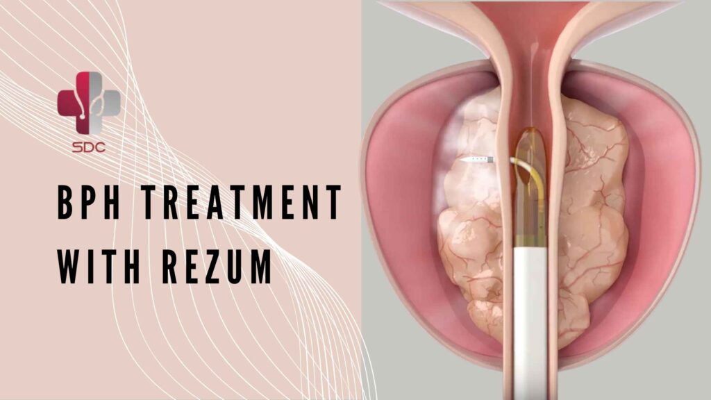 A urologist explaining BPH treatment options to a patient