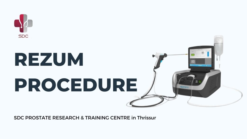 REZUM procedure for BPH treatment - SDC Prostate Research & Training Centre