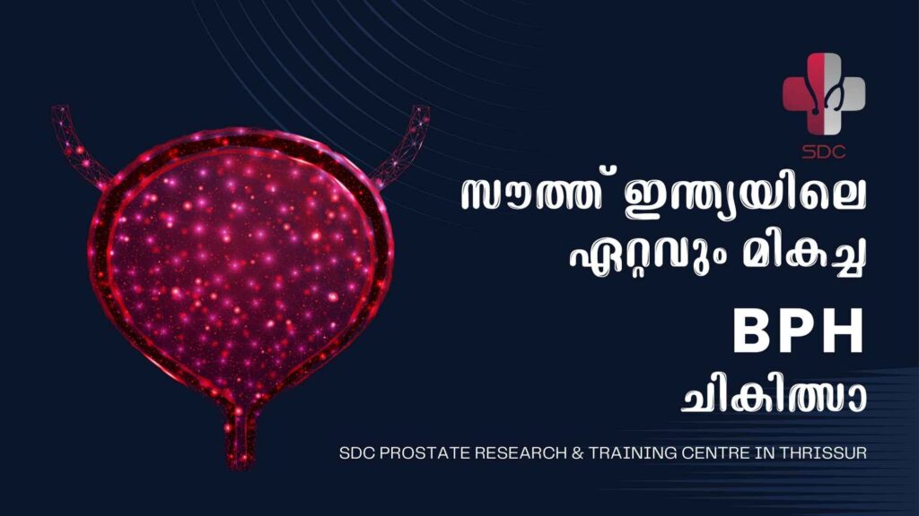 Advanced BPH Treatment at SDC Prostate Research & Training Centre in Thrissur