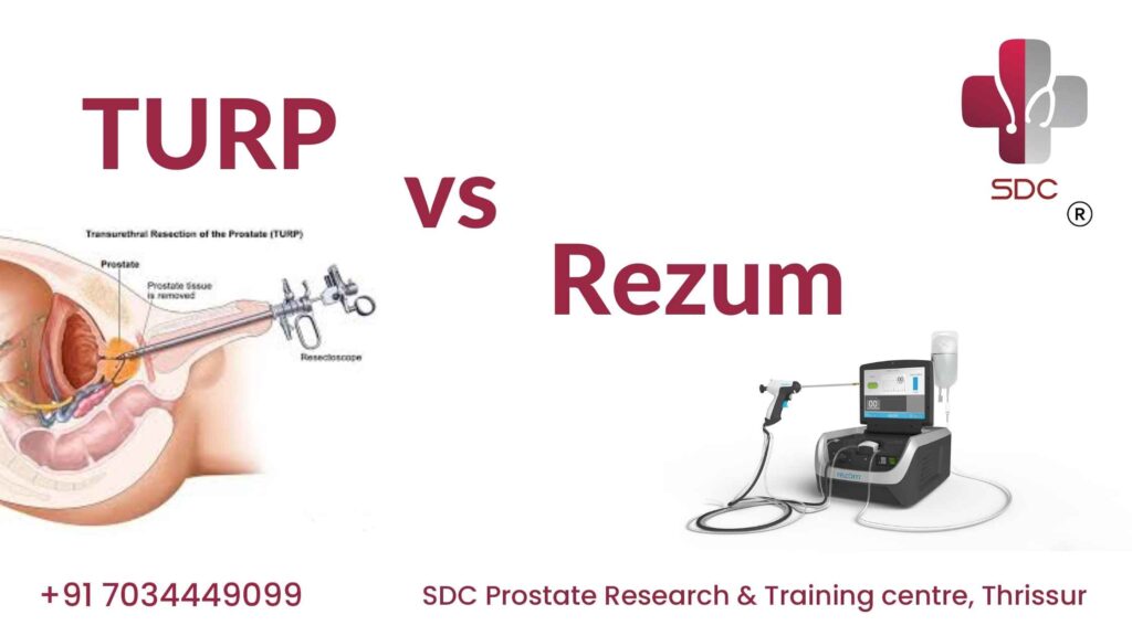 Comparison of TURP and Rezūm prostate treatments, highlighting differences in procedure, recovery time, and effectiveness.