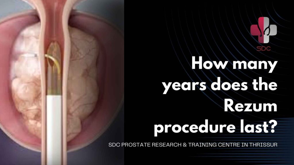 Rezum procedure for BPH treatment at SDC Prostate Research & Training Centre, Thrissur