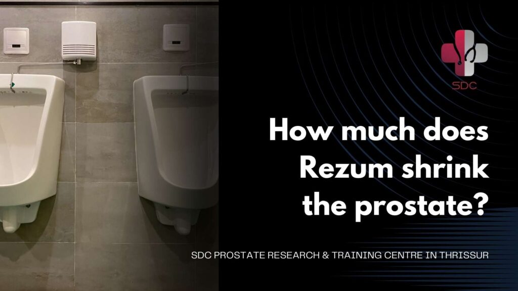 Rezum prostate treatment procedure at SDC PROSTATE RESEARCH & TRAINING CENTRE in Thrissur