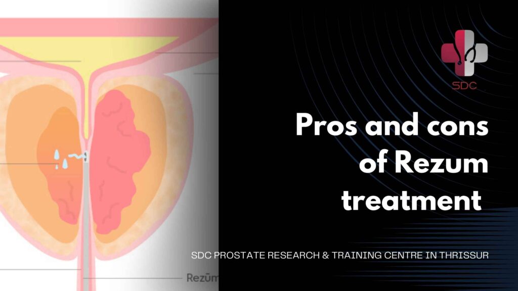 Rezum treatment procedure at SDC Prostate Research & Training Centre, Thrissur