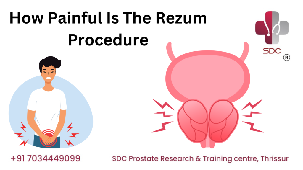 Patient receiving the Rezum procedure with minimal discomfort, showcasing the minimally invasive water vapor therapy for BPH treatment