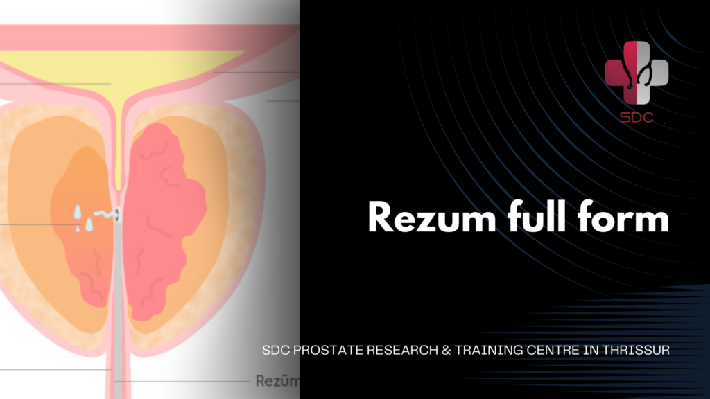 Doctor explaining the Rezum procedure for prostate treatment using steam therapy