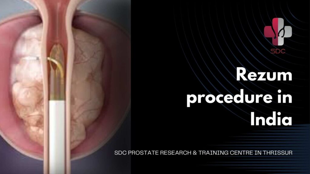 Rezum procedure for BPH treatment in India at SDC Prostate Research & Training Centre, Thrissur