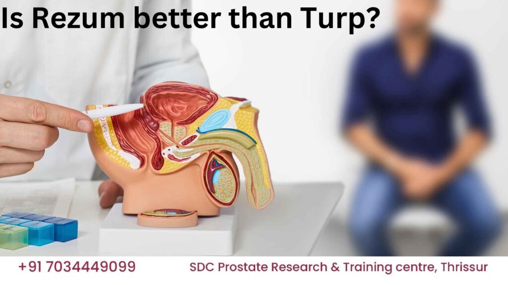 Comparison of Rezum Water Vapor Therapy and TURP treatment for BPH, available at SDC Prostate Research Centre in Thrissur