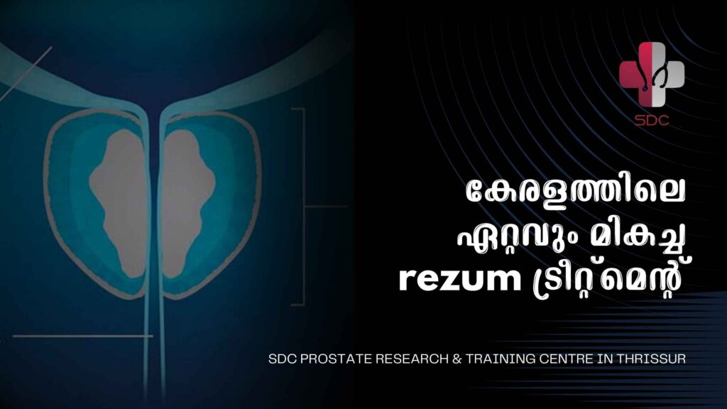 Rezūm treatment for BPH at SDC Prostate Research & Training Centre, Thrissur