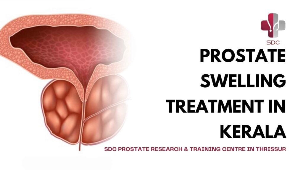 Advanced Prostate Swelling Treatment in Kerala