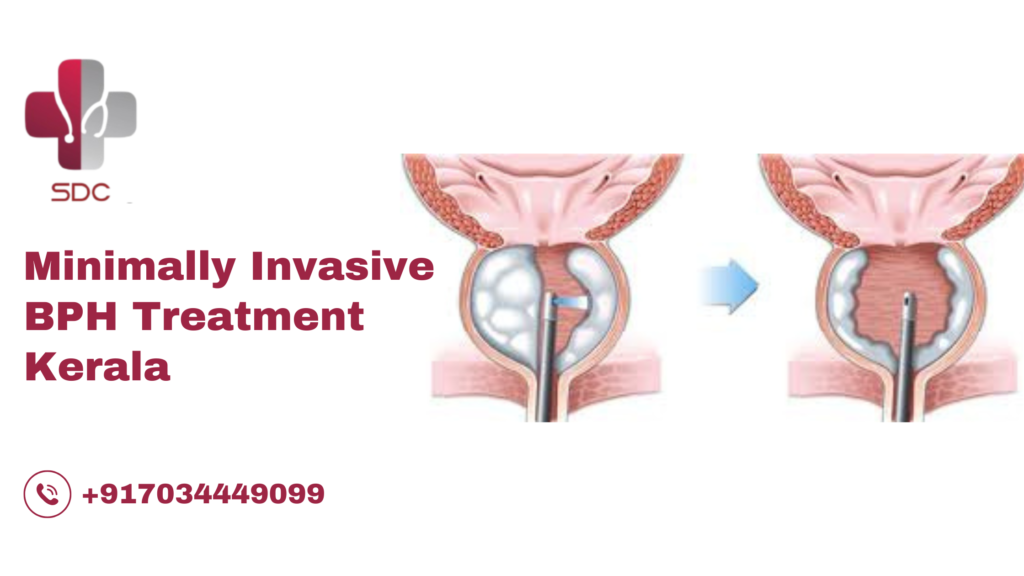 Doctor performing minimally invasive BPH treatment in Kerala clinic.