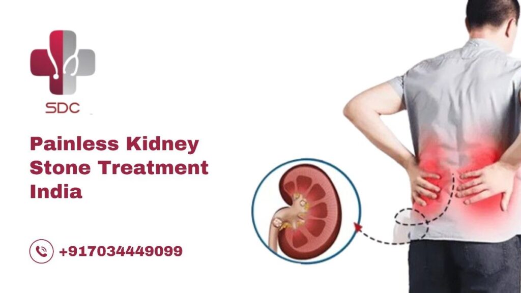 Close-up of minimally invasive kidney stone removal procedure at SDC