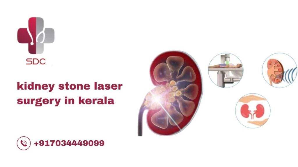 Modern laser equipment used for kidney stone surgery at Specialist Doctors Centre in Kerala