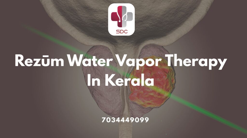 Rezūm water vapor therapy being performed for benign prostatic hyperplasia treatment in Kerala
