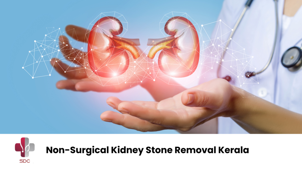 non-surgical kidney stone removal Kerala