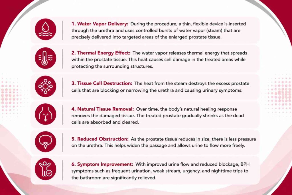 How Does Rezum Therapy Work for BPH